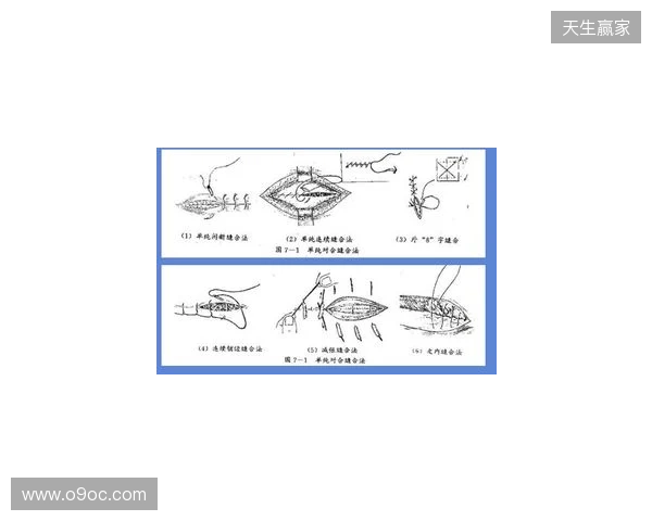 广州豹官方：杨浩眉弓伤口缝合30余针，预计5-7天后拆线